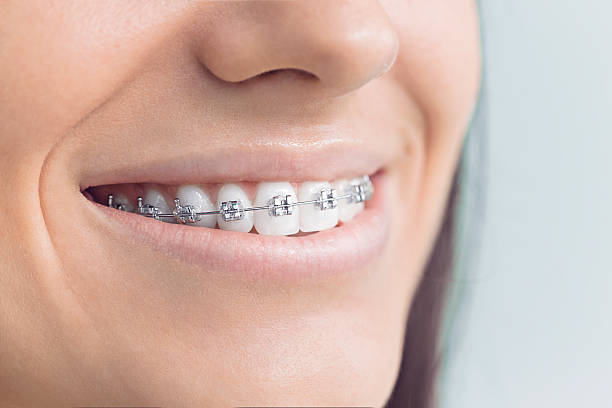 Full Mouth Reconstruction in South Dos Palos, CA